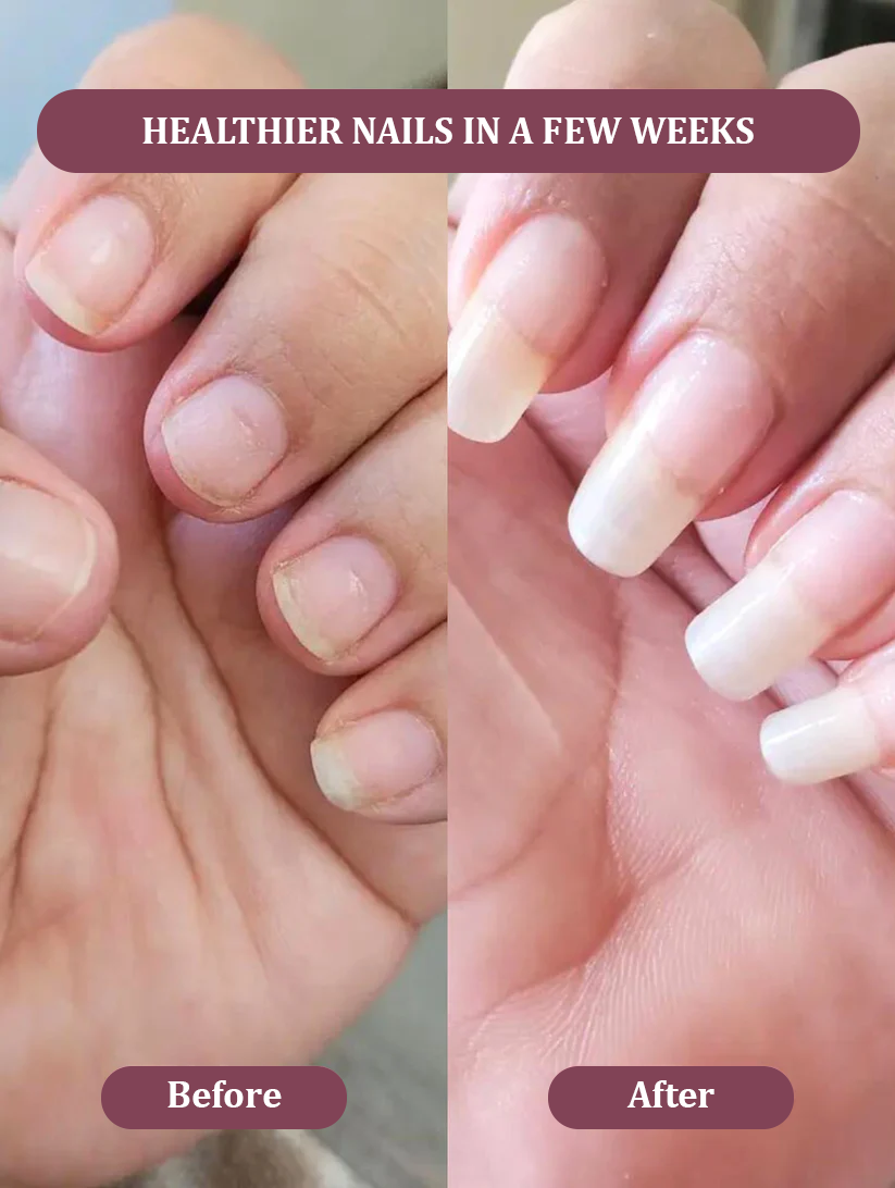 CANDY Nail Growth Oil